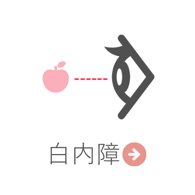 白内障